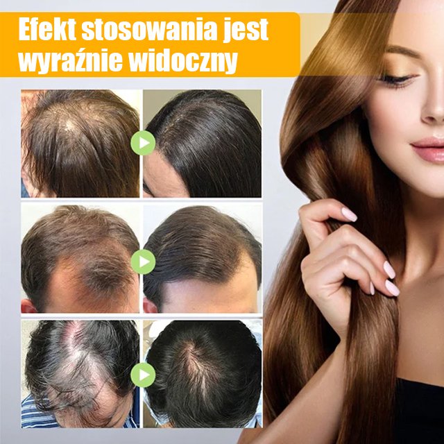 Biotyna spray na porost włosów